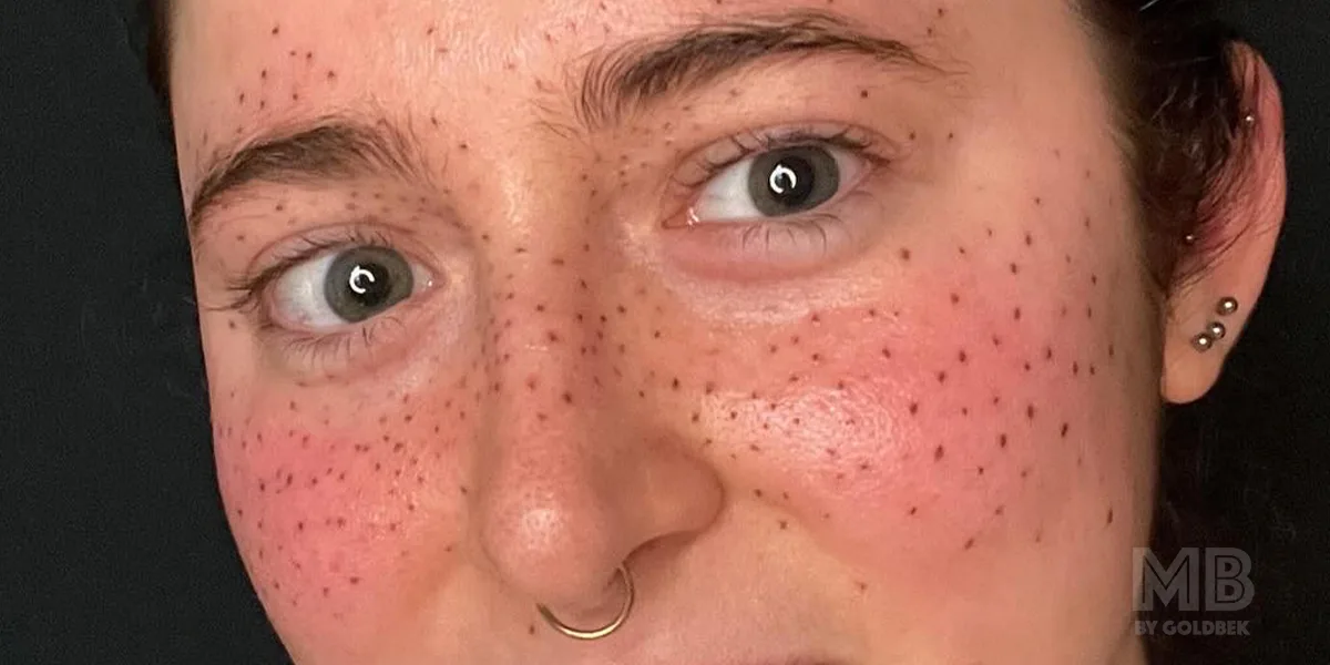 Explore the Enchantment of Freckle Tattoos!