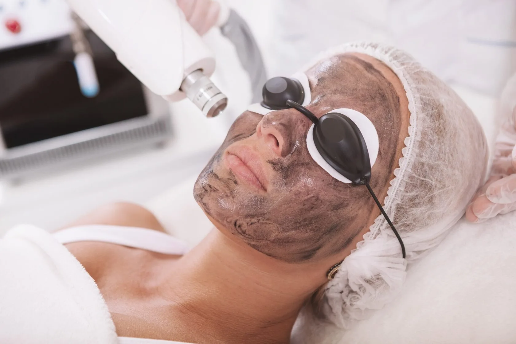 Revolutionize Your Skin with Our Painless Carbon Peel Laser Treatment!