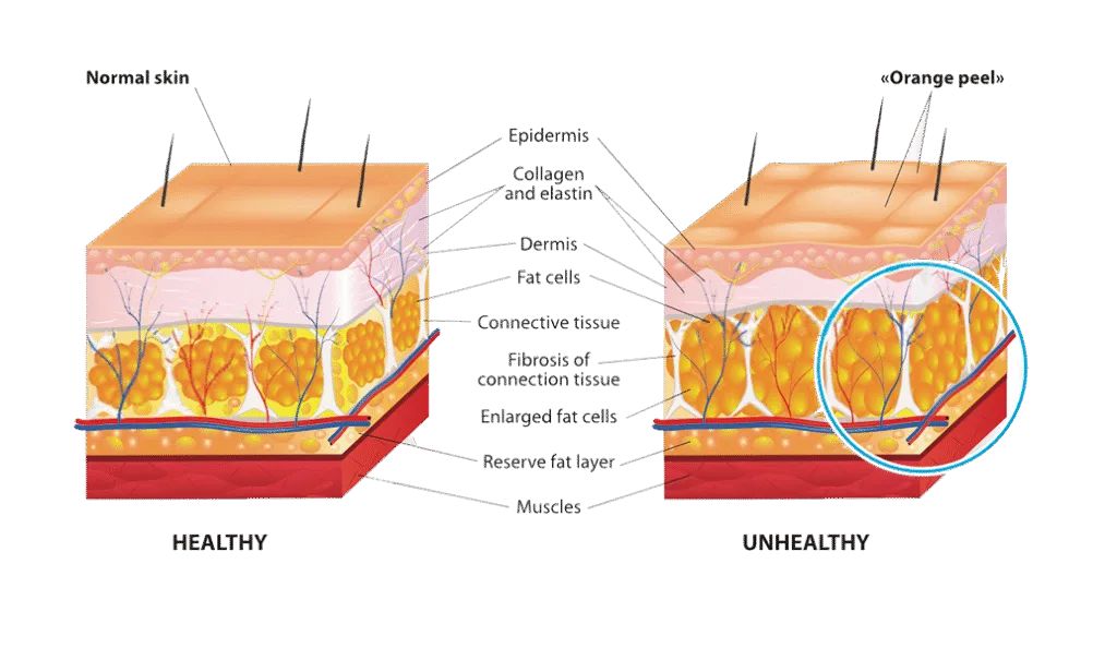 Healthy Skin