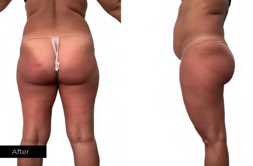 result-after-6-treatments